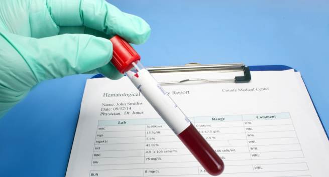 WBC trong xét nghiệm máu là gì